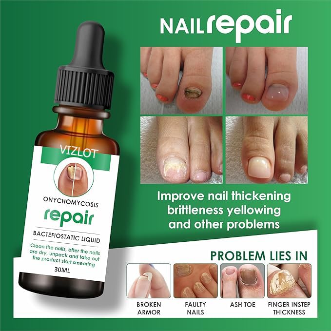 "NailStrong™ Growth & Repair Oil – 30ml | Almond-Enriched Nail Serum for Healthy, Shiny Nails"