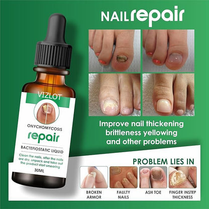 "NailStrong™ Growth & Repair Oil – 30ml | Almond-Enriched Nail Serum for Healthy, Shiny Nails"